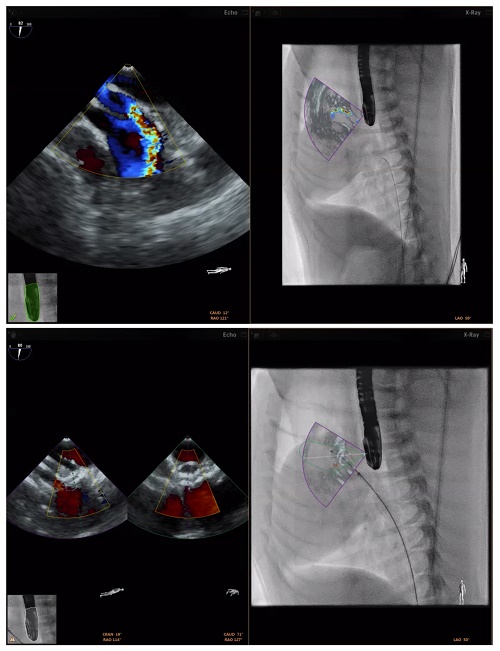 Rover’s Regurgitation VeterinarianCardiologist Teamwork Could Speed Device Innovation